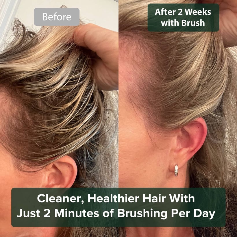 No Shampoo Hair Brush
